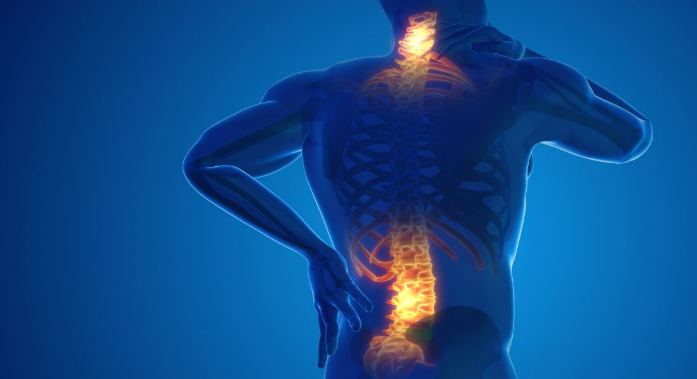 What Doctor to See for Back Pain?